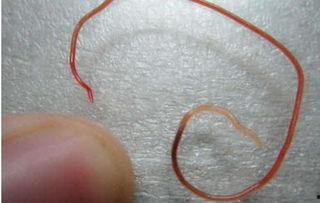 吃瓜会长蛔虫吗,揭秘吃瓜与蛔虫感染的关系